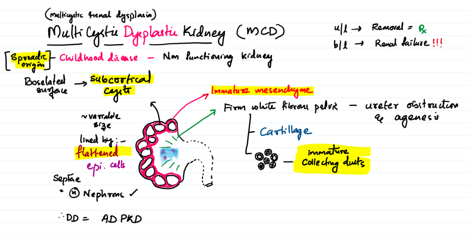 Multicystic renal dysplasia or multicystic dysplastic kidney – Pathonotes