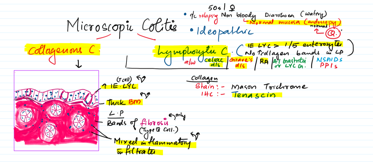 Microscopic colitis – Collagenous colitis, Lymphocytic colitis – Pathonotes